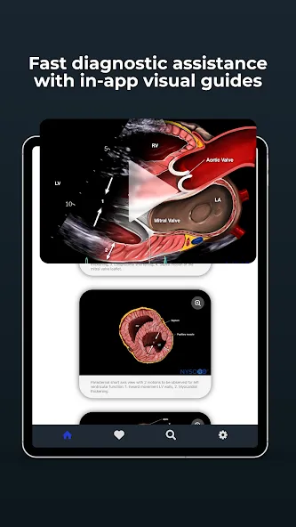 Point of Care Ultrasound screenshot 11