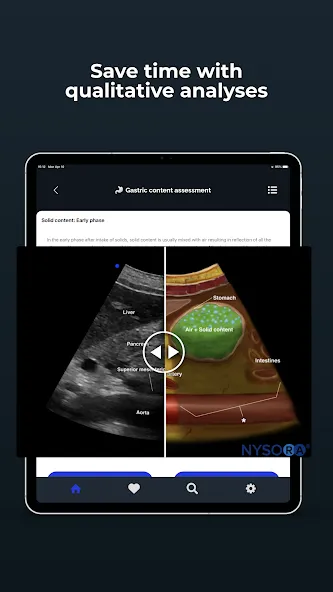 Point of Care Ultrasound screenshot 13