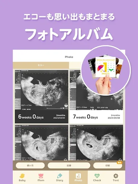 トツキトオカ:夫婦で共有できる『妊娠記録・日記』アプリ screenshot 14