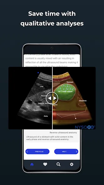 Point of Care Ultrasound screenshot 5