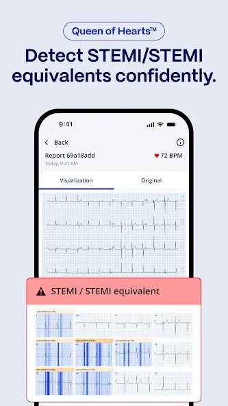 PMcardio for Individuals screenshot 3